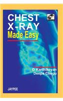 Chest X-Ray Made Easy with Photo CD-ROM