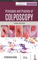 Principles and Practice of Colposcopy