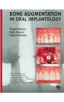 Bone Augmentation in Oral Implantology