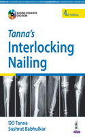 Tanna'S Interlocking Nailing With Dvd-Rom