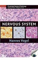 Nervous System