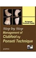 Step by Step Management of Clubfoot by Ponseti Technique (with DVD-ROM)