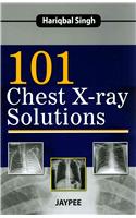 101 Chest X-Ray Solutions