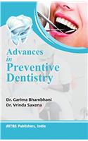 Advances in Preventive Dentistry