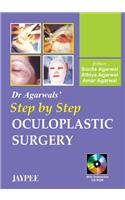 Dr. Agarwal's Step by Step Oculoplastic Surgery