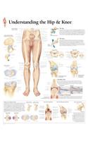 Understanding the Hip & Knee Laminated Poster