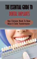 The Essential Guide To Dental Implants