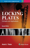 Locking Plates Concepts And Applications, 2E