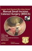 Jaypee Gold Standard Mini Atlas Series Manual Small incision Cataract Surgery (MSICS) with DVD-ROM