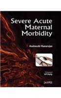 Severe Acute Maternal Morbidity