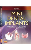 Mini Dental Implants