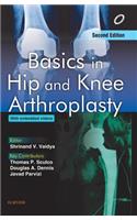 Basics in Hip and Knee Arthroplasty