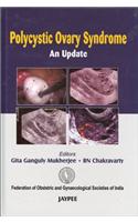 Polycystic Ovary Syndrome: An Update(FOGSI)