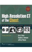 High-Resolution CT of the Chest: Comprehensive Atlas