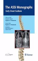 The ASSI Monographs: Early Onset Scoliosis