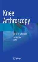 Knee Arthroscopy