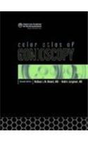 Color Atlas of Gonioscopy